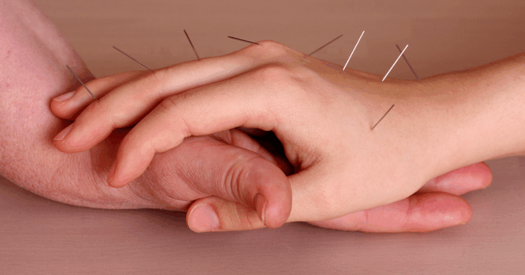 how-acupuncture-may-help-raynaud’s-syndrome