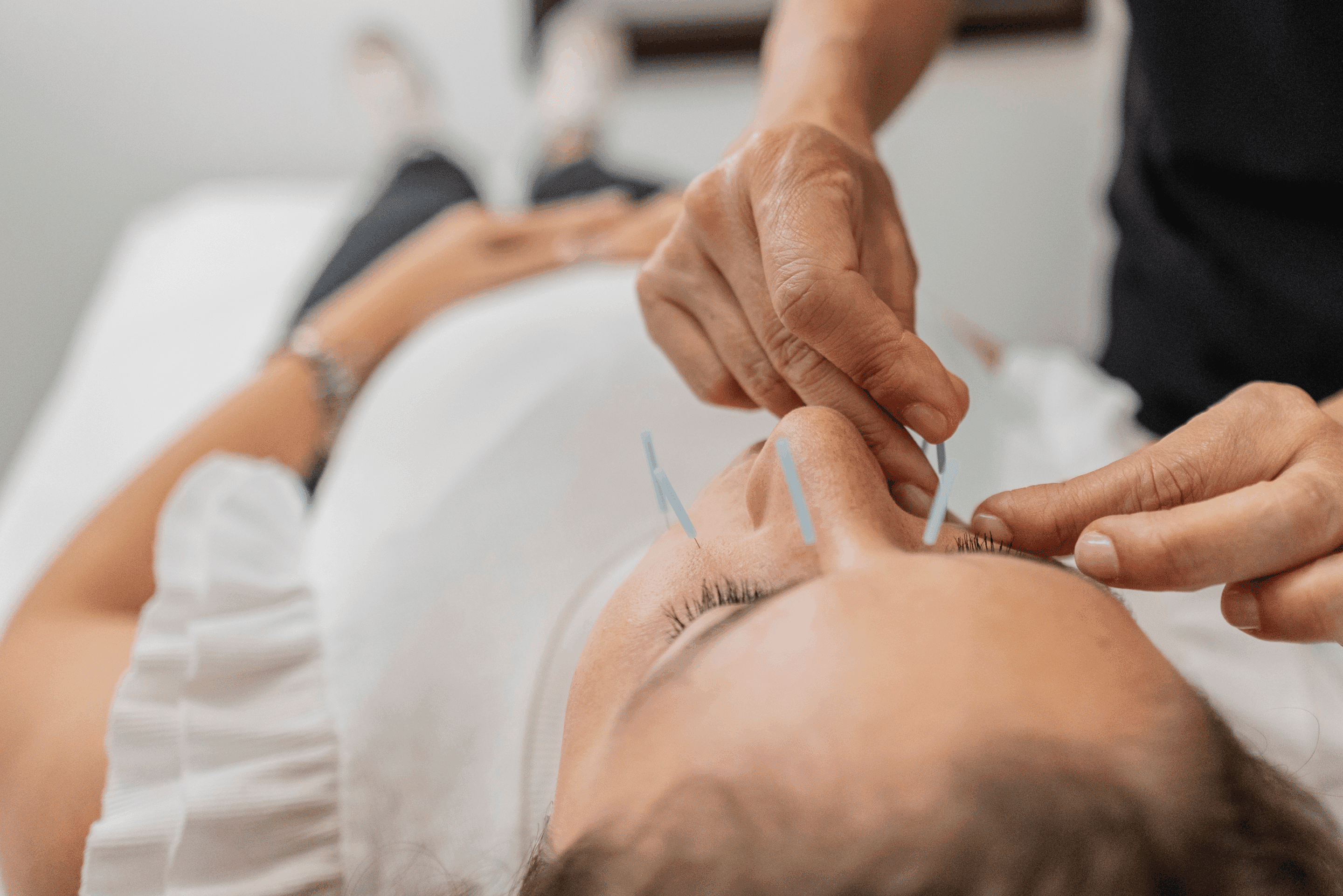 After Acu Facial Treatment