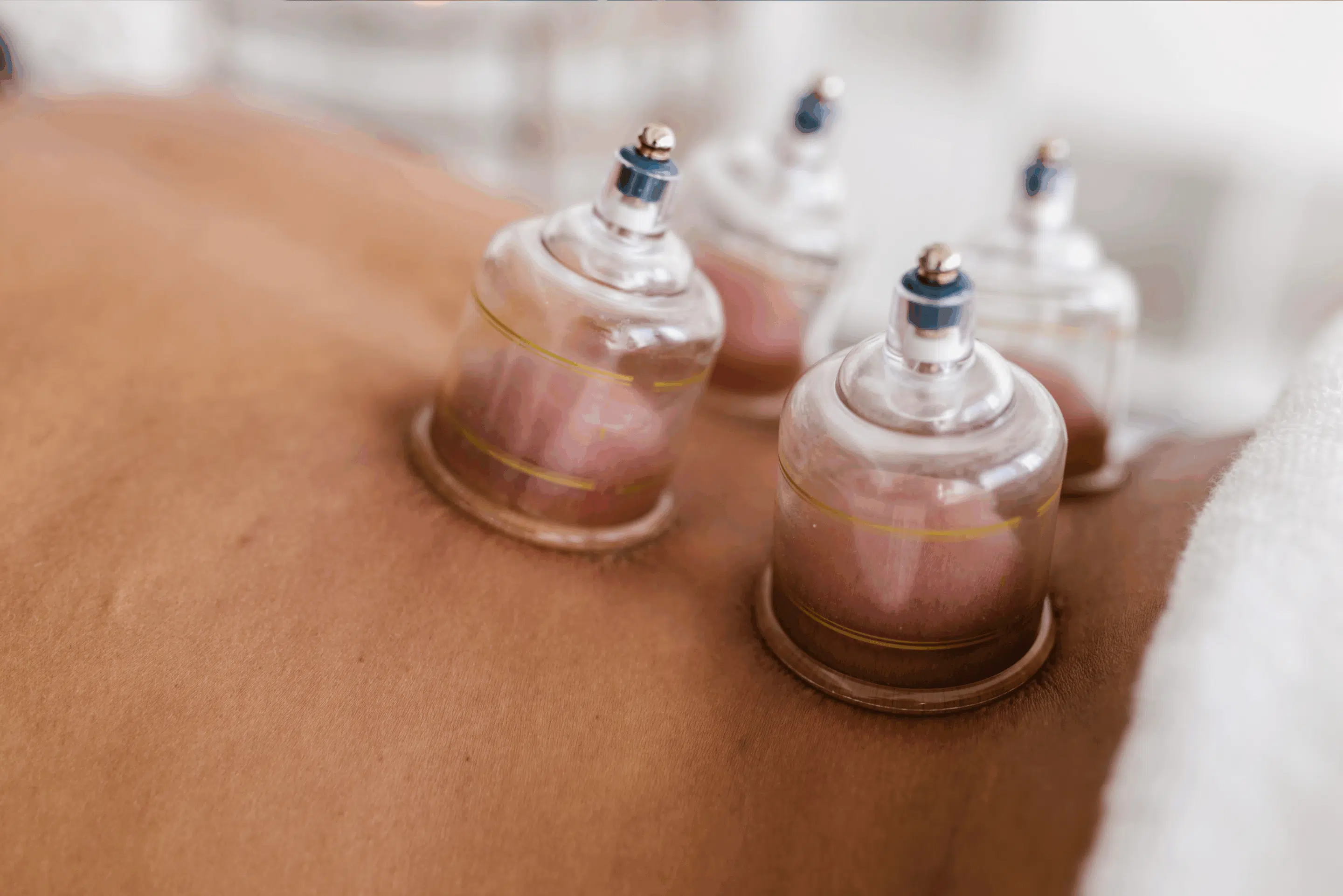 Best Cupping Therapy in NYC