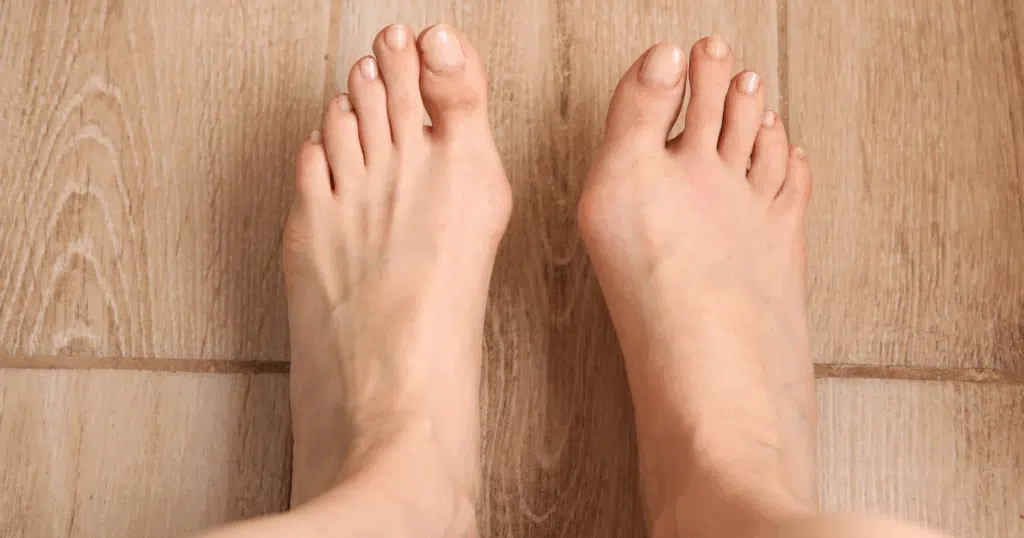 LV3 Acupuncture Point (Tai Chong)