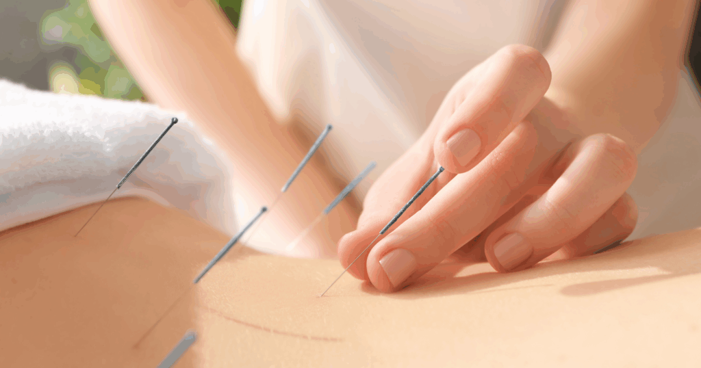 What Makes Pediatric Acupuncture Different From Adult Acupuncture