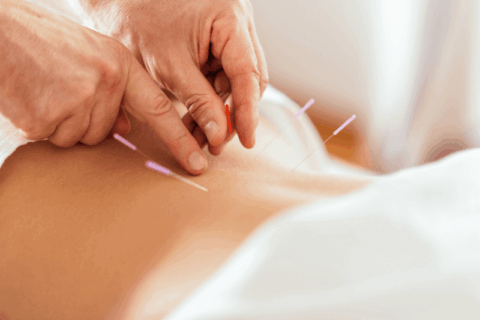 How Long Does It Take for Acupuncture to Work?