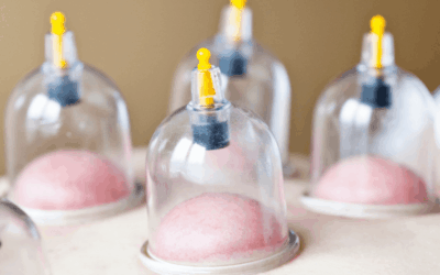 Wet Cupping vs Dry Cupping: Benefits, Risks, and Treatment Considerations
