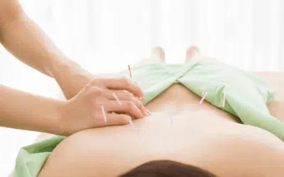 What to Expect During an Acupuncture Session: A Step-by-Step Guide for First-Time Patients