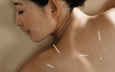 Acupuncture for Women: Natural Support for Stress, Sleep, and Hormonal Balance