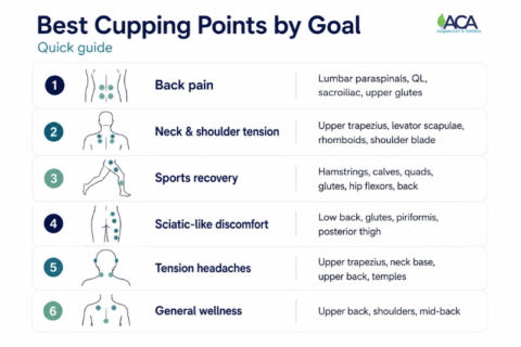 Culing Point Zones Cupping Therapy Points: Key Areas Used for Pain Relief, Recovery, and ...