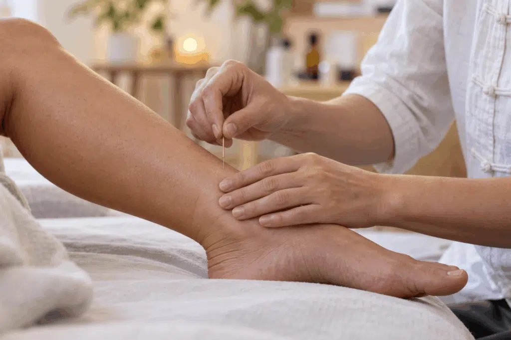 Acupuncturist examining and treating a patient’s lower leg and ankle