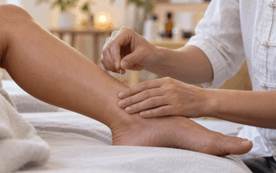 SP6 Acupuncture Point: Location, Traditional Uses, and What Patients Should Know